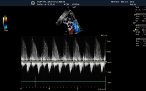 critical thinking in ultrasound