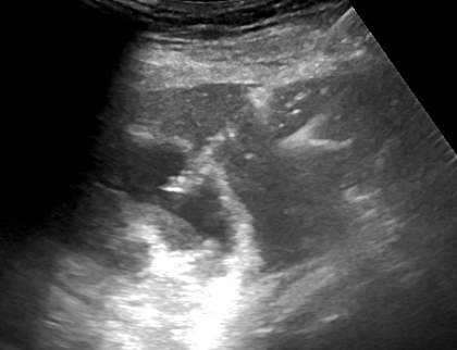 critical thinking in ultrasound